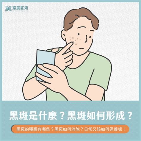 臉上黑斑|如何去除黑斑？雷射治療與預防方法的建議，以及黑斑。